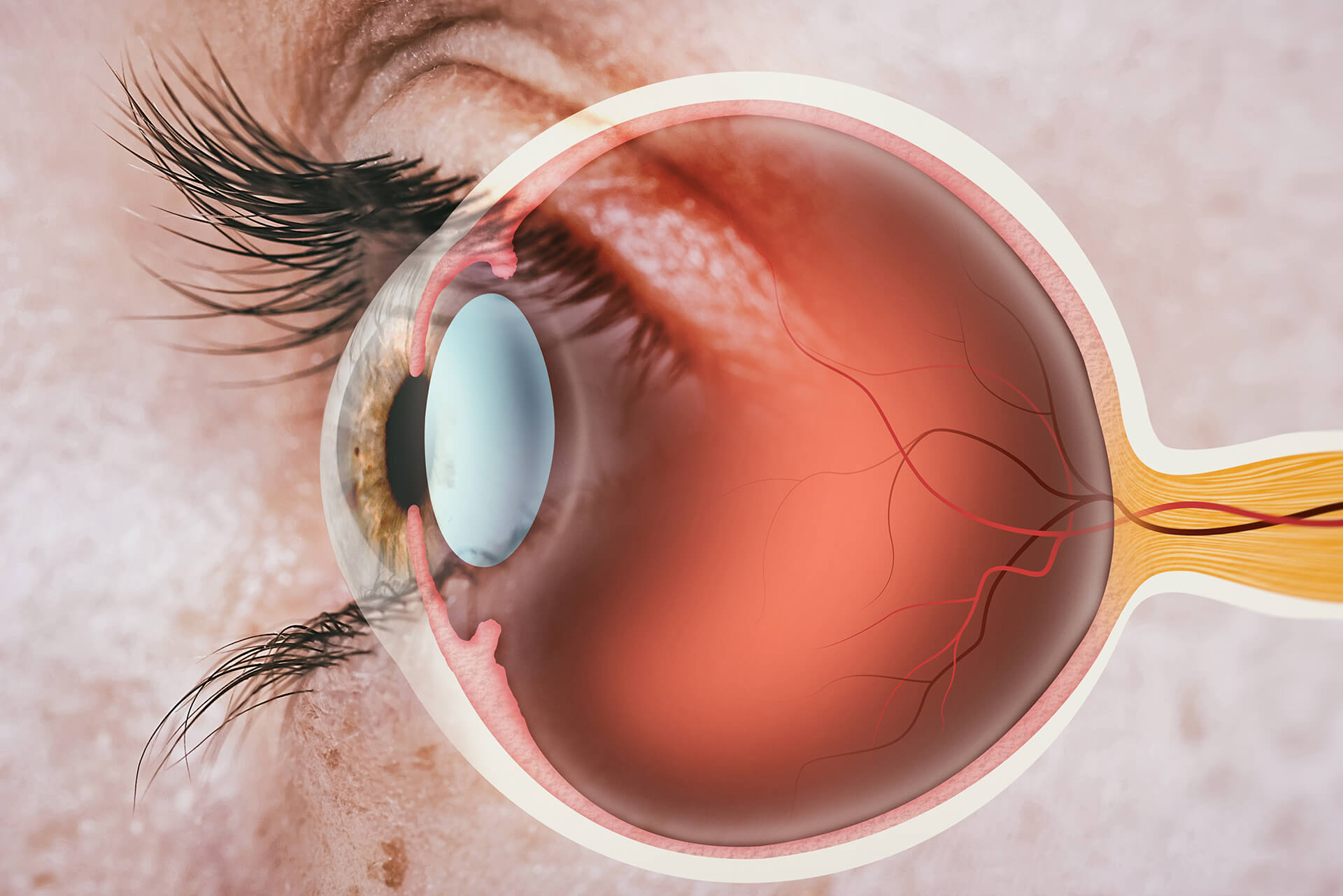 Retina Chart